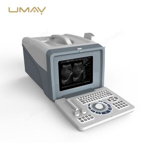 Portable-Ultrasound-Scanner-UMY-US-PO01-Hot-Sell-in-Africa-1