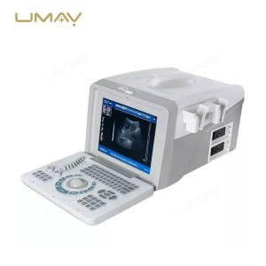 Portable-Ultrasound-Scanner-UMY-US-PO01-Hot-Sell-in-Africa-2