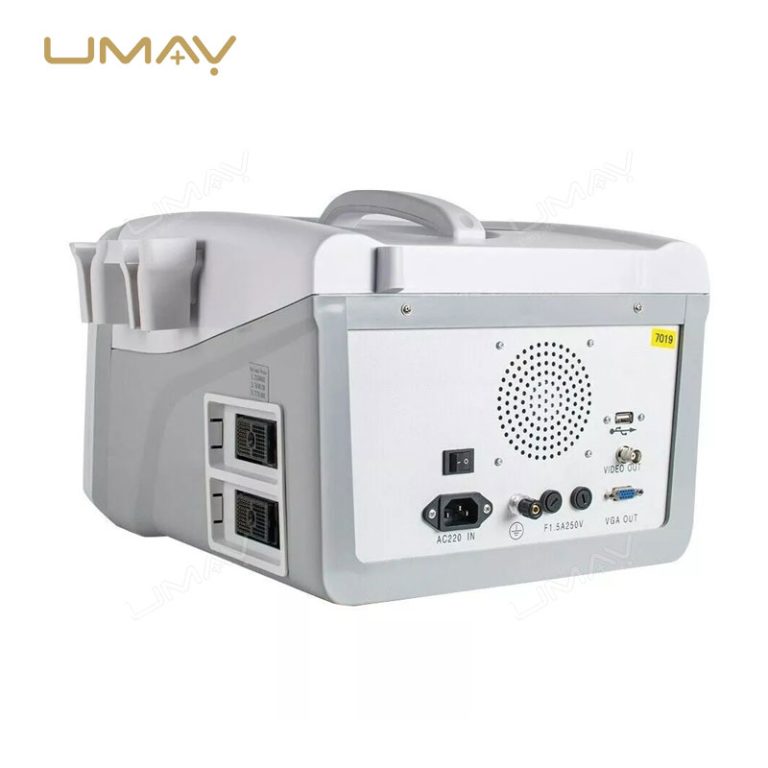 Portable-Ultrasound-Scanner-UMY-US-PO01-Hot-Sell-in-Africa-3