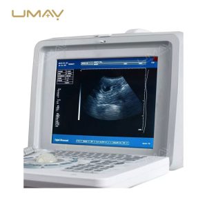 Portable-Ultrasound-Scanner-UMY-US-PO01-Hot-Sell-in-Africa-4