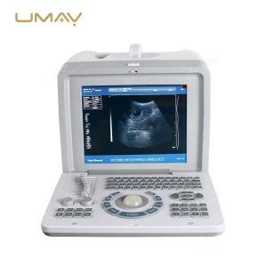 Portable-Ultrasound-Scanner-UMY-US-PO01-Hot-Sell-in-Africa-6