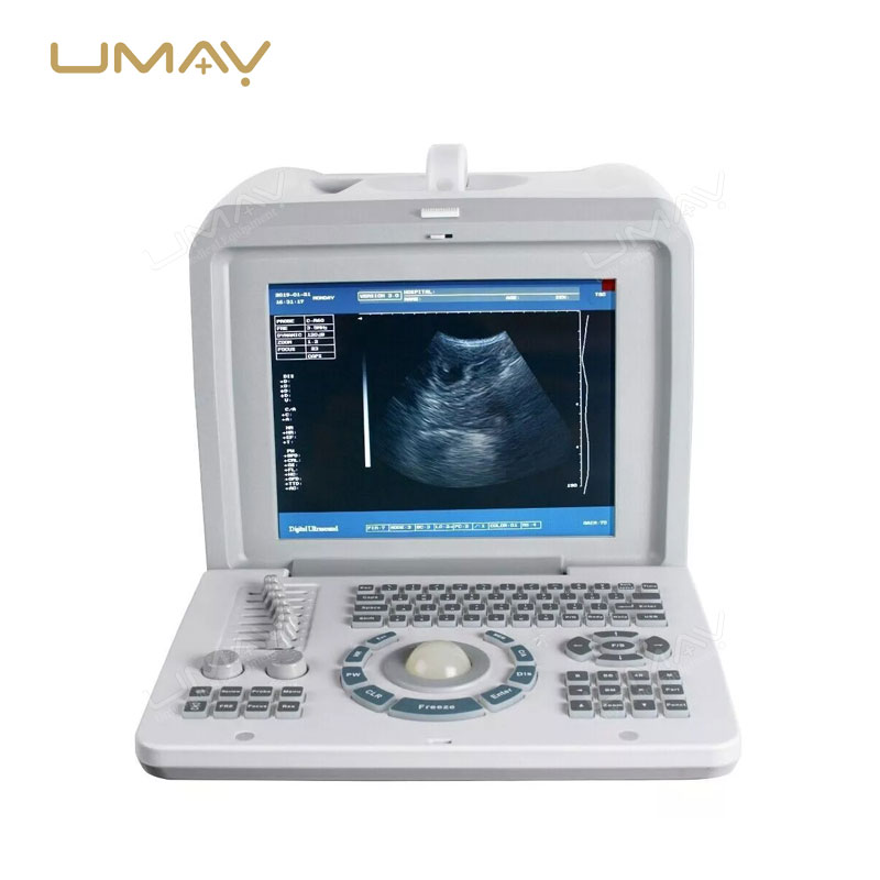 Portable Ultrasound Scanner UMY-US-PO01 Hot Sell in Africa