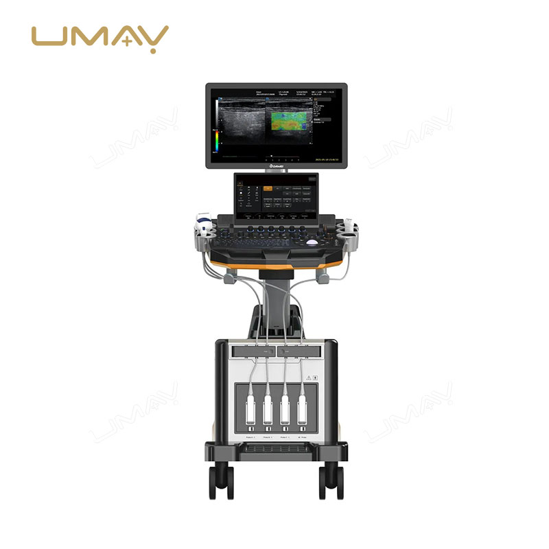 Trolley Doppler Ultrasound Device UMY-US-TR01 From Trustworthy Manufacturer