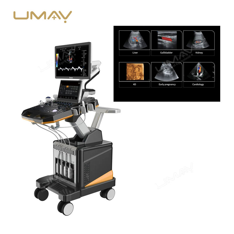 Trolley Doppler Ultrasound Device UMY-US-TR01 From Trustworthy Manufacturer