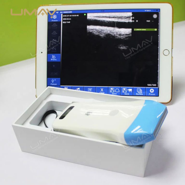 128-Element Handheld Wireless Linear Ultrasound Scanner with WiFi Connectivity-1