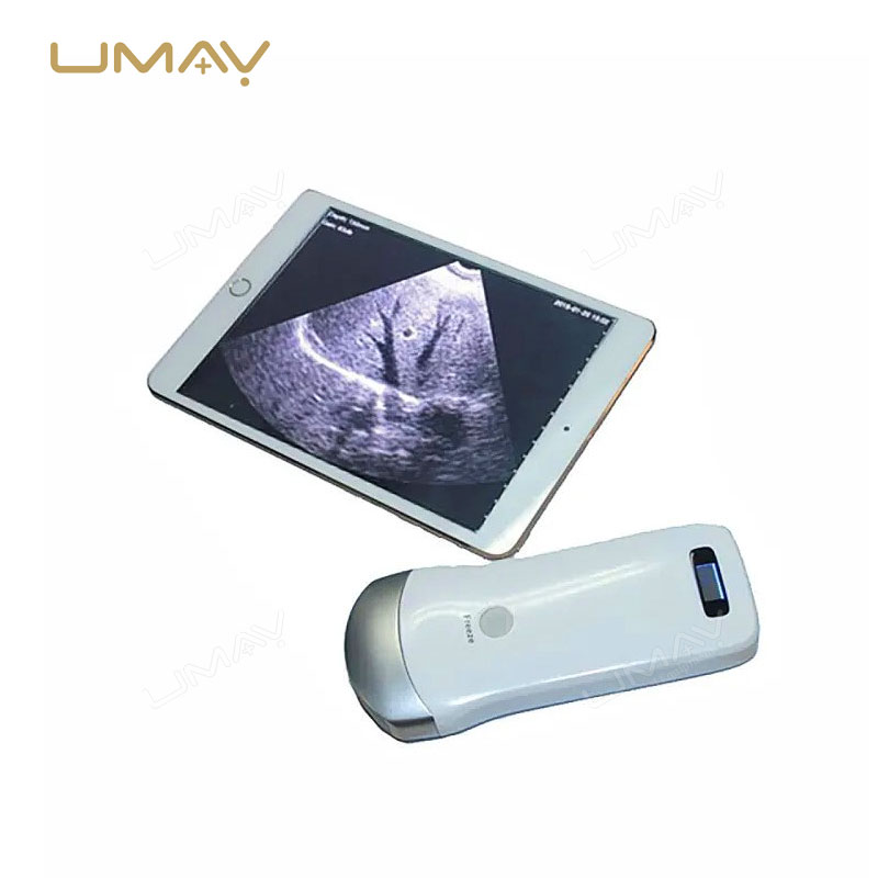 128-Element Wireless Ultrasound Scanner for Portable Imaging