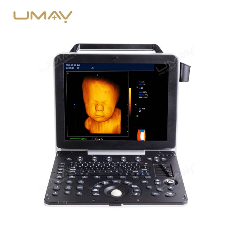 15-Inch High-Resolution Portable 4D 5D Color Doppler Ultrasound Machine-1