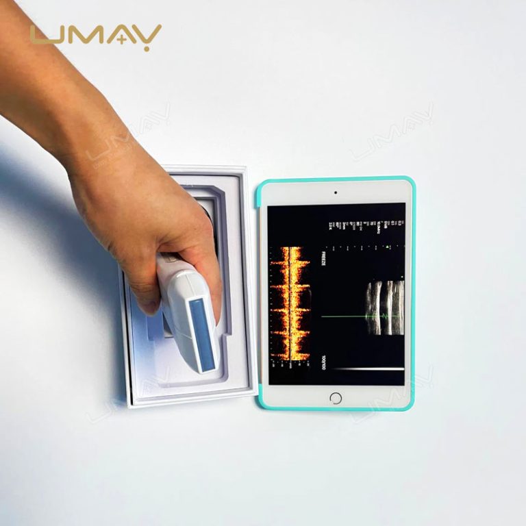 192-Element Handheld Wireless Linear Array Ultrasound Probe-3