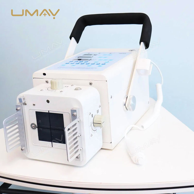 2.8kW Portable Digital X-ray Machine with Built-in Battery for Enhanced Mobility