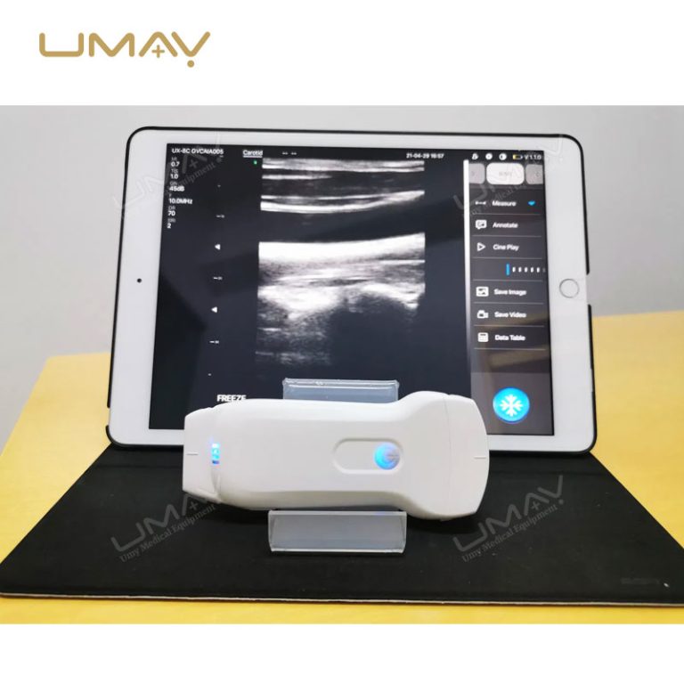 3-in-1 Portable Wireless Ultrasound with Linear and Convex Probes-1