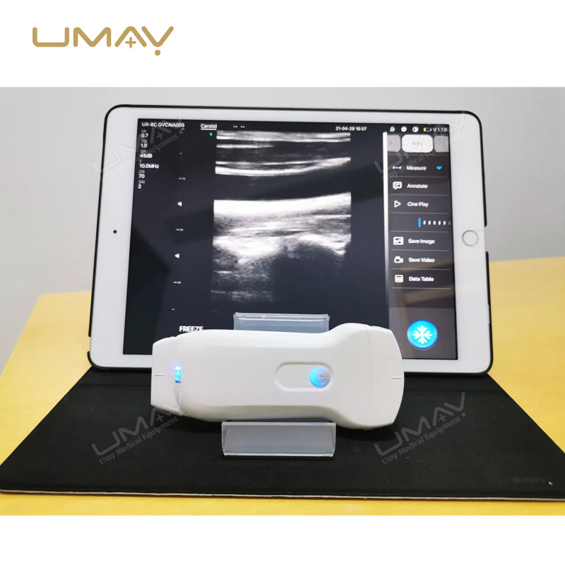 3-in-1 Portable Wireless Ultrasound with Linear and Convex Probes