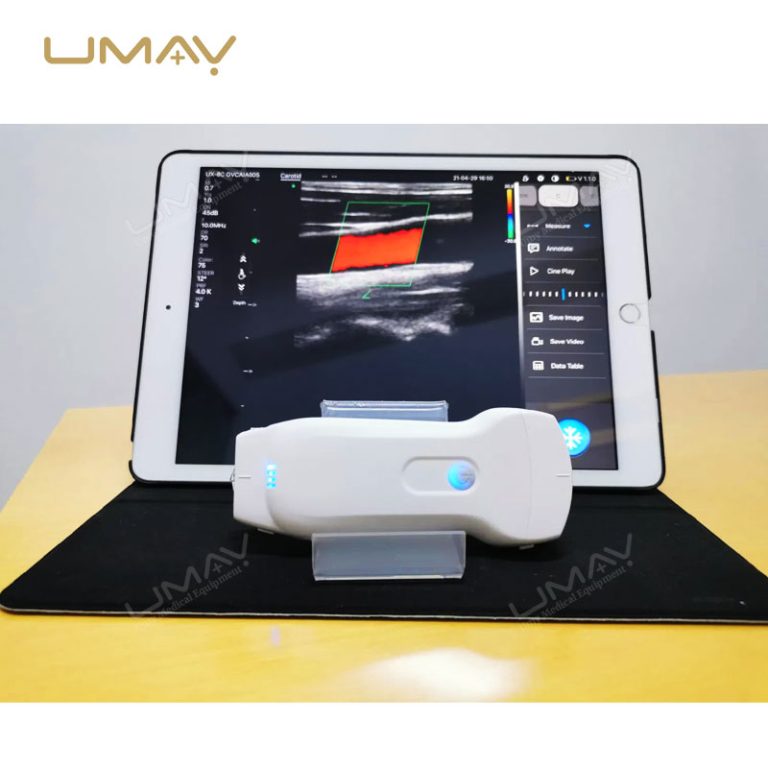 3-in-1 Portable Wireless Ultrasound with Linear and Convex Probes-2