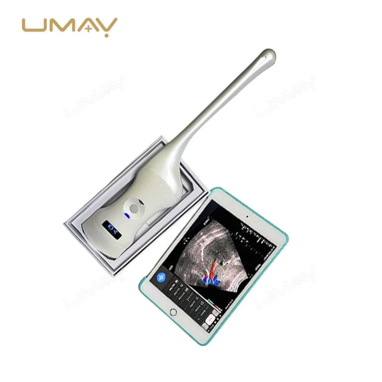 3-in-1 Wireless Color Doppler Ultrasound Scanner with Convex, Phased, and Transvaginal Array Probes-1