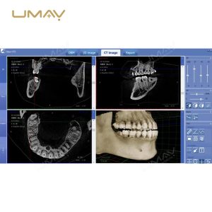 3D CBCT Panoramic and Cephalometric Dental X-ray Machine for Comprehensive Imaging-4