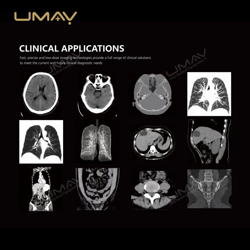 Affordable 32-slice CT Scanner with Professional Advanced Technology