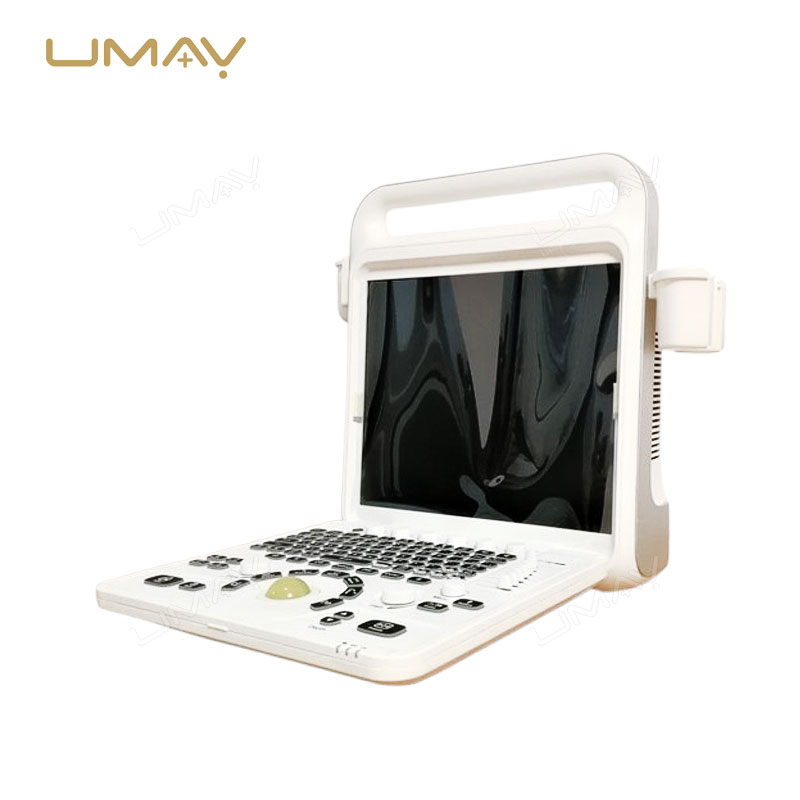 Cost-Effective Full Digital Color Doppler Ultrasound System with 160GB SSD Storage