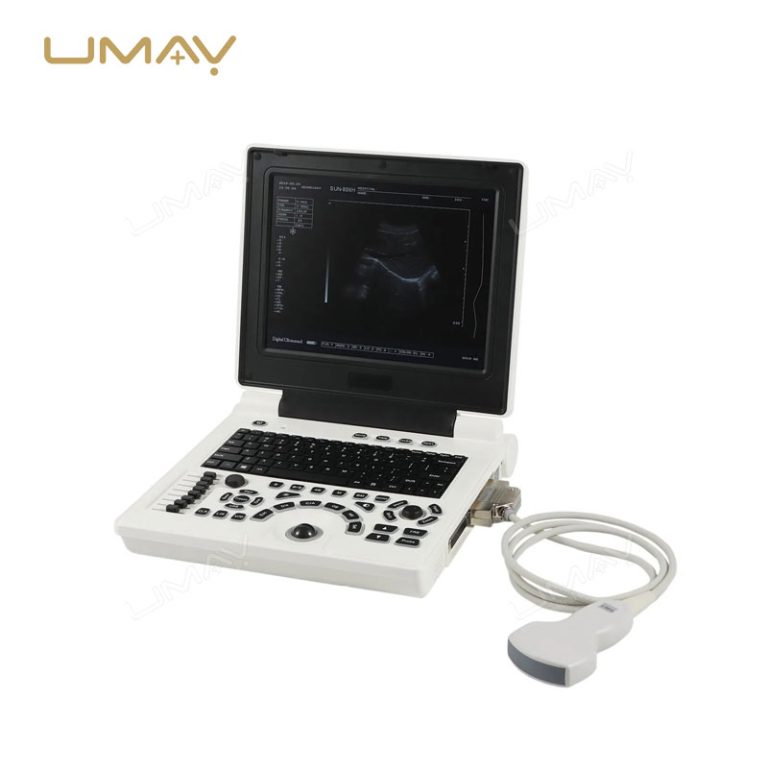 Digital Black and White Laptop Ultrasound Machine at Factory Price