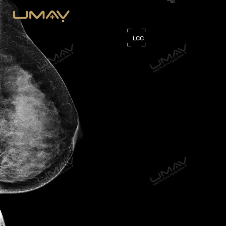 Digital Mammography System for Breast Disease Examination with DR Technology-5