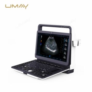 Factory Price 4D OEM Full Digital Color Doppler Laptop Ultrasound for Pediatric Cardiac Imaging-2