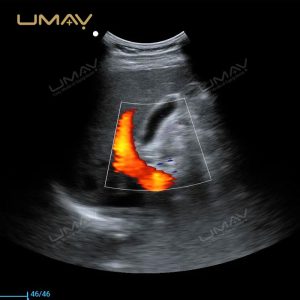 Factory Price 4D OEM Full Digital Color Doppler Laptop Ultrasound for Pediatric Cardiac Imaging-4