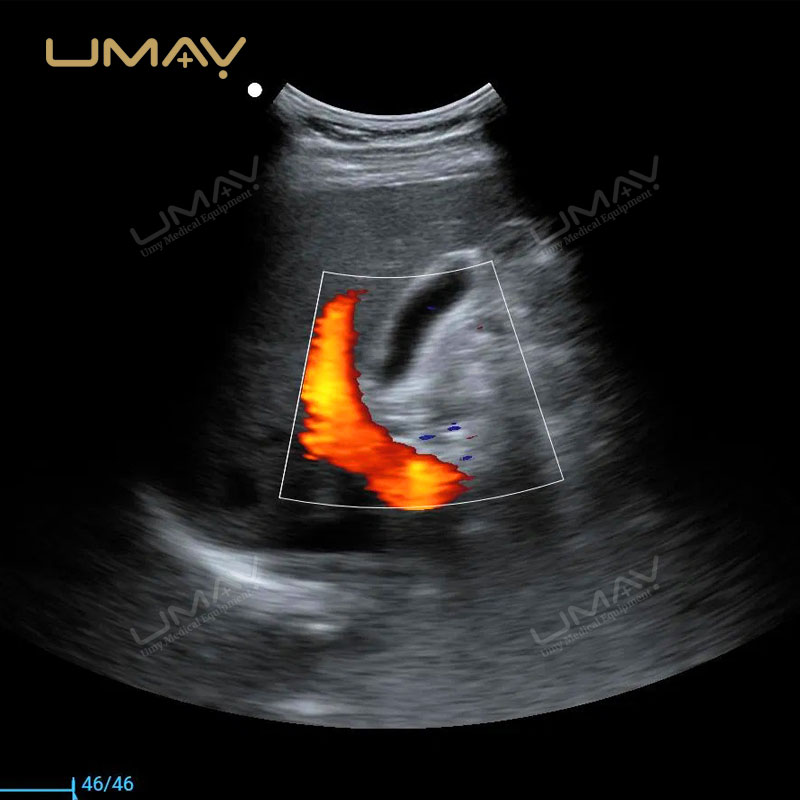 Factory Price 4D OEM Full Digital Color Doppler Laptop Ultrasound for Pediatric Cardiac Imaging