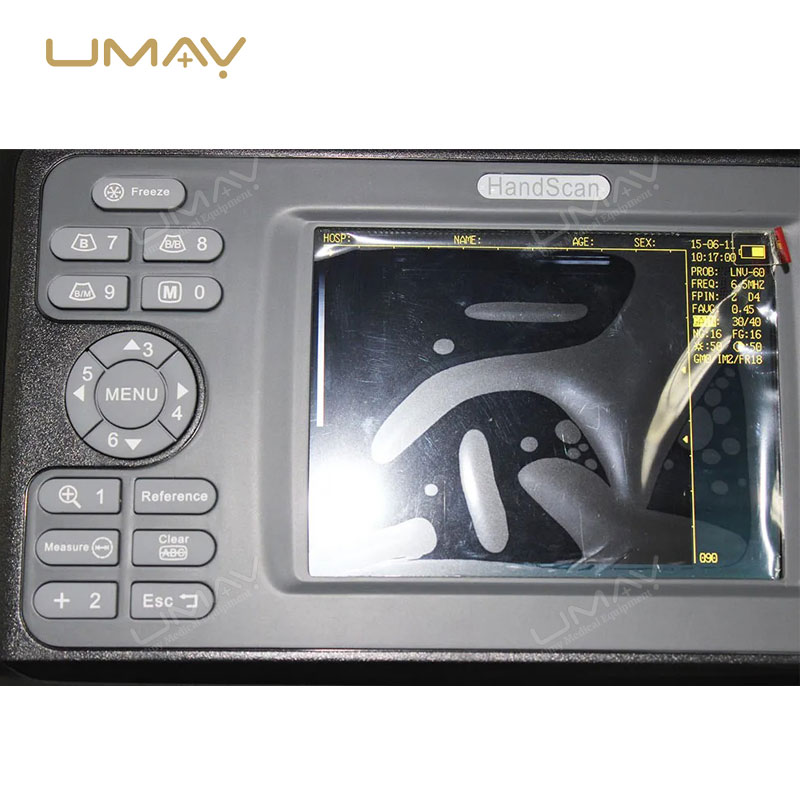 Handheld Veterinary Ultrasound Diagnostic Instrument for Animal Health