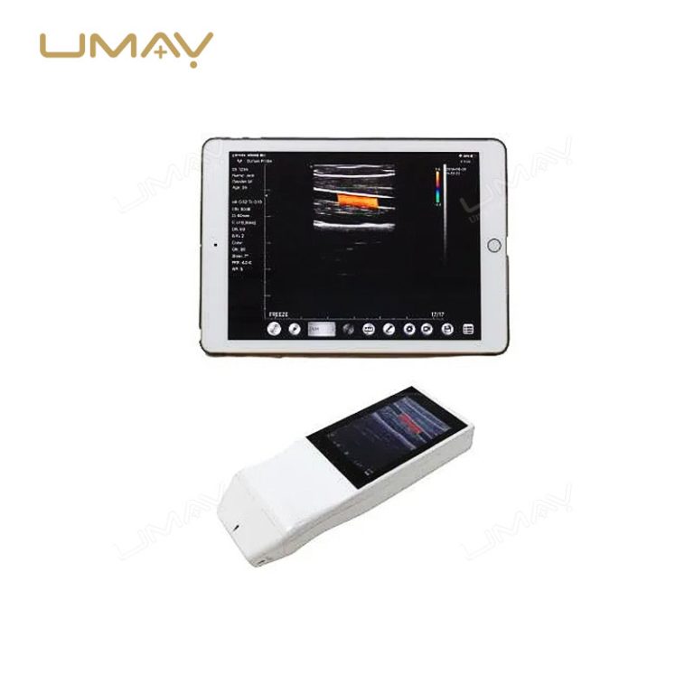 Handheld Wireless Linear Array Ultrasound Probe with WiFi Connectivity-1