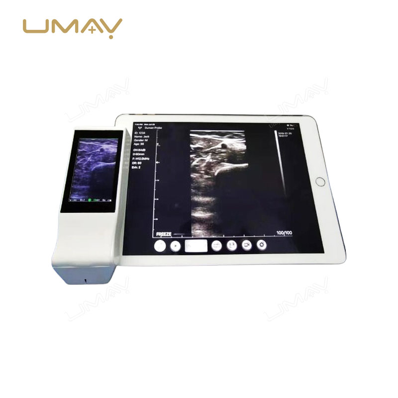 Handheld Wireless Linear Array Ultrasound Probe with WiFi Connectivity