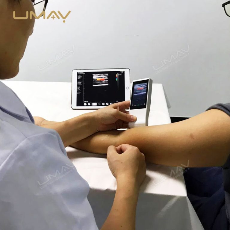 Handheld Wireless Linear Array Ultrasound Probe with WiFi Connectivity-3