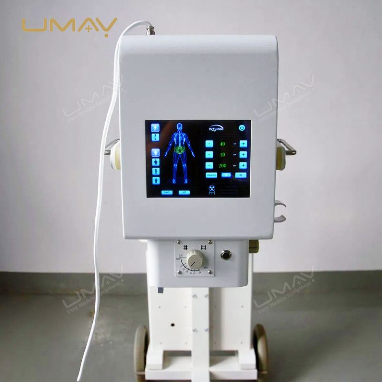 High-Power Mobile Digital X-ray Machine for Advanced Medical Imaging-2