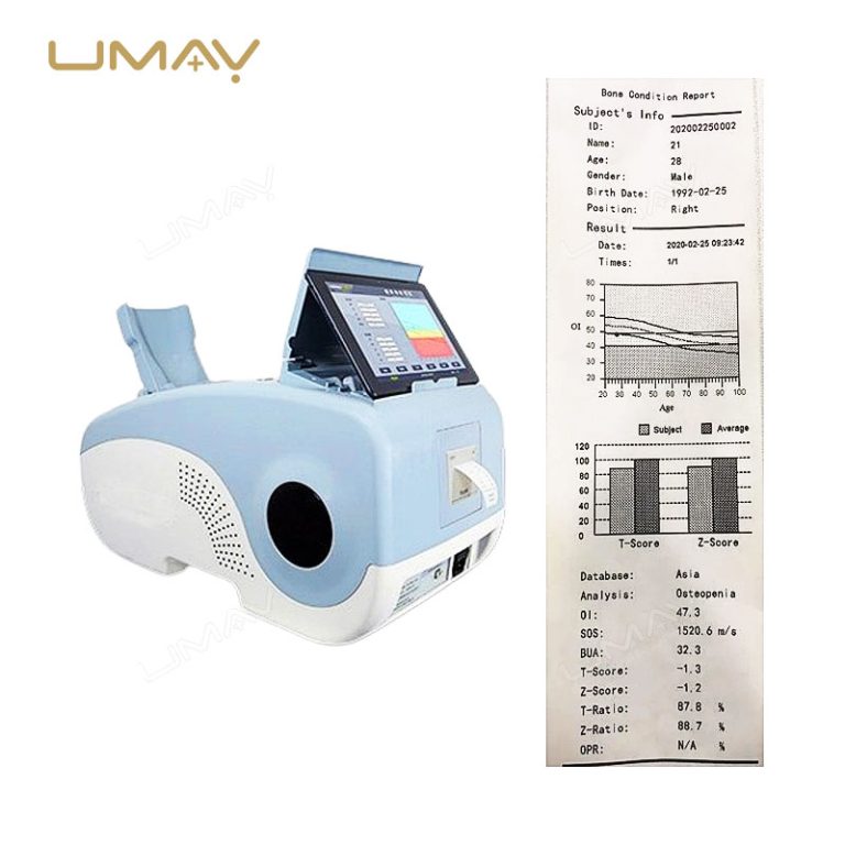 High-Quality Calcaneus Ultrasound Bone Densitometer for Bone Health Assessment-1