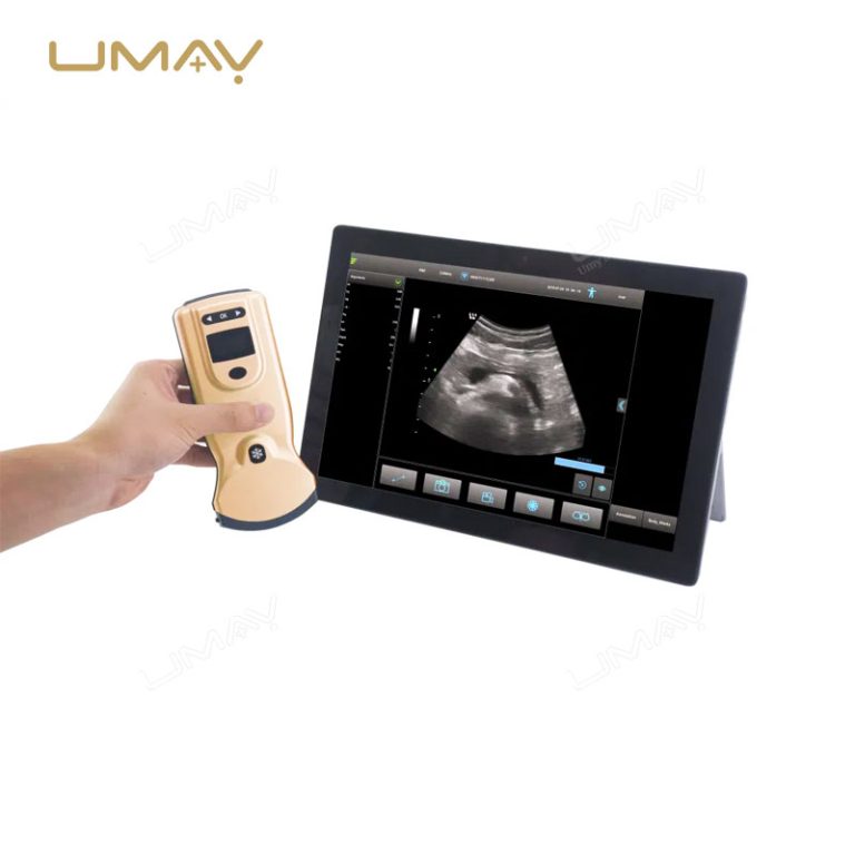 Latest Model Wireless Color Doppler Ultrasound Convex Probe, 80 Elements, 32 Channels-3