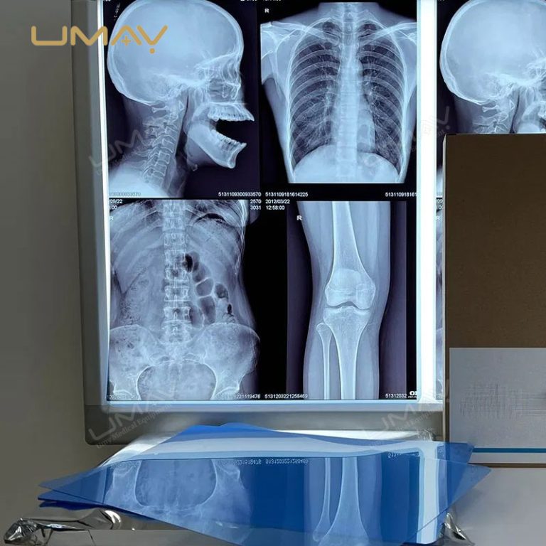 Medical Inkjet Printer for X-ray Blue Film, CT, and MRI Imaging-2