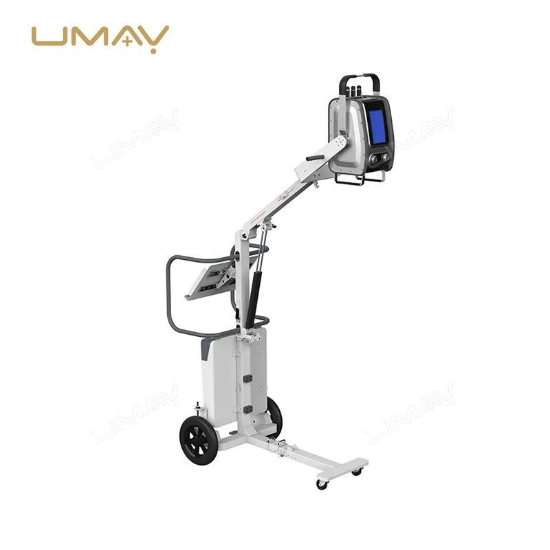 Mobile Digital Portable X-ray Machine for Versatile Medical Imaging