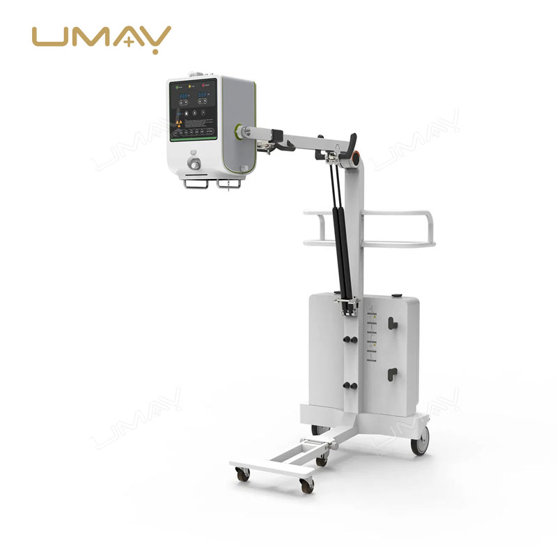 New Mobile Digital Medical X-ray Radiography Machine for Versatile Imaging