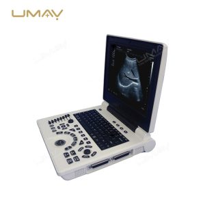 Portable 3D 4D Color Doppler Ultrasound Machine with High-Quality Imaging-2