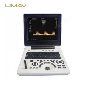 Portable 3D 4D Color Doppler Ultrasound Machine with High-Quality Imaging-3