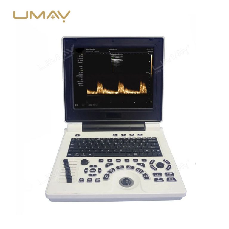 Portable 3D 4D Color Doppler Ultrasound Machine with High-Quality Imaging-3