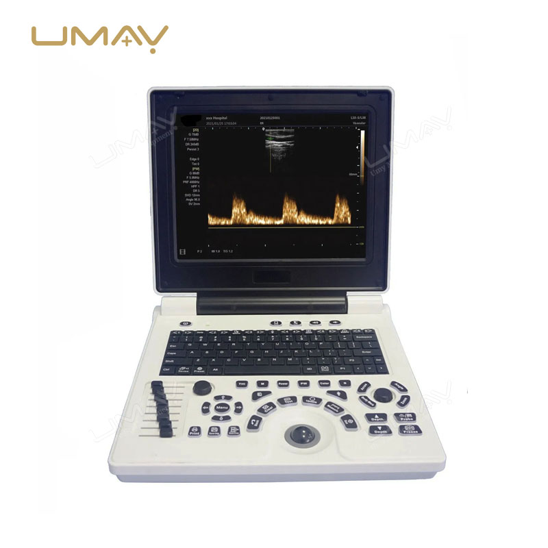 Portable 3D/4D Color Doppler Ultrasound Machine with High-Quality Imaging