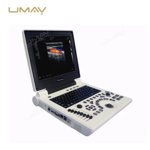 Portable 3D 4D Color Doppler Ultrasound Machine with High-Quality Imaging-4