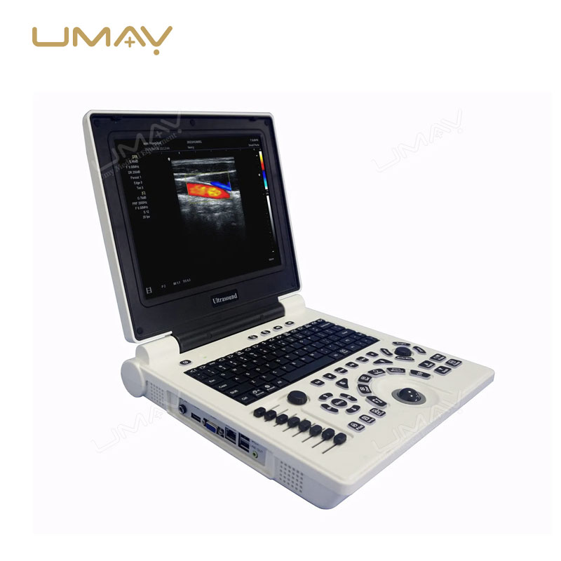 Portable 3D/4D Color Doppler Ultrasound Machine with High-Quality Imaging