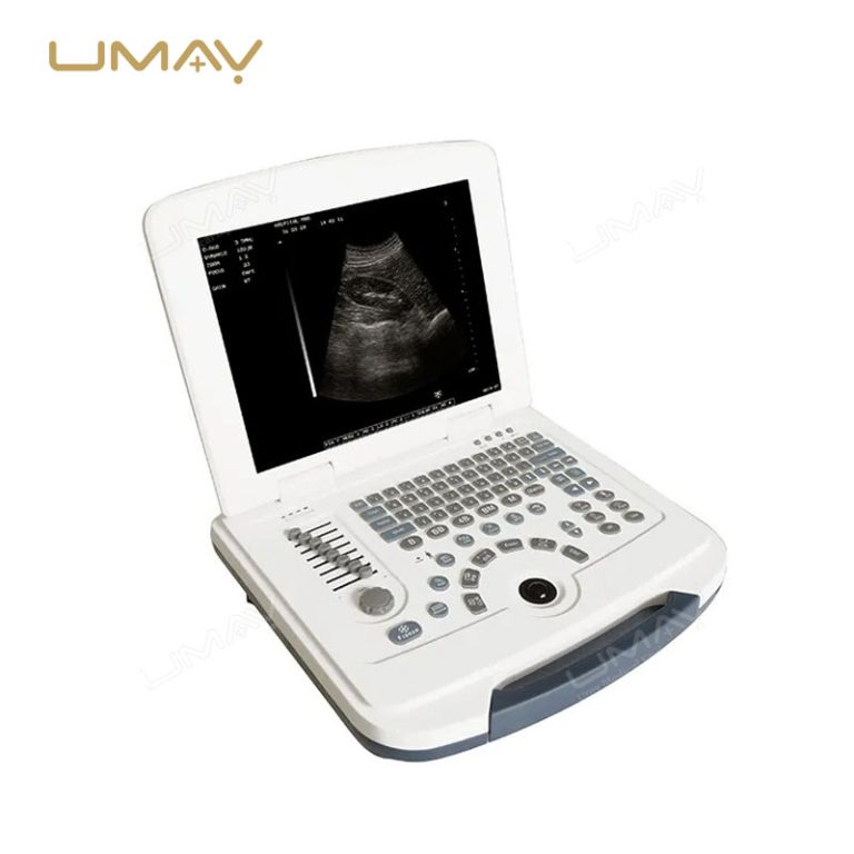 Portable Black and White Ultrasound Scanner Machine for Medical Imaging-1