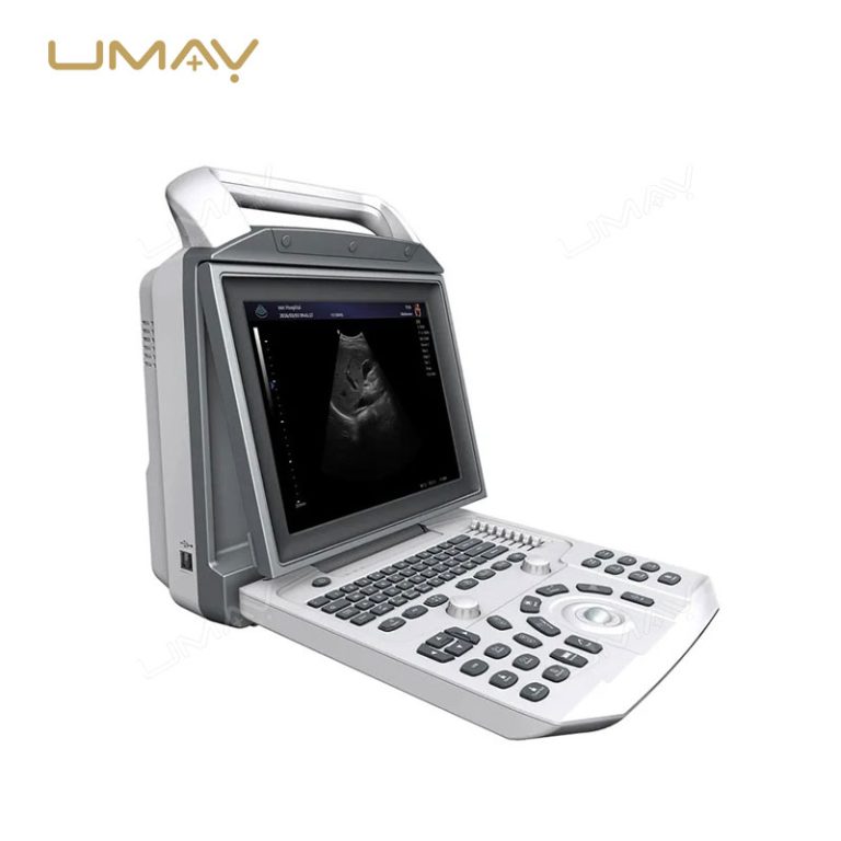 Portable Black and White Ultrasound Scanner with 12-Inch LED Screen for Human and Veterinary Use