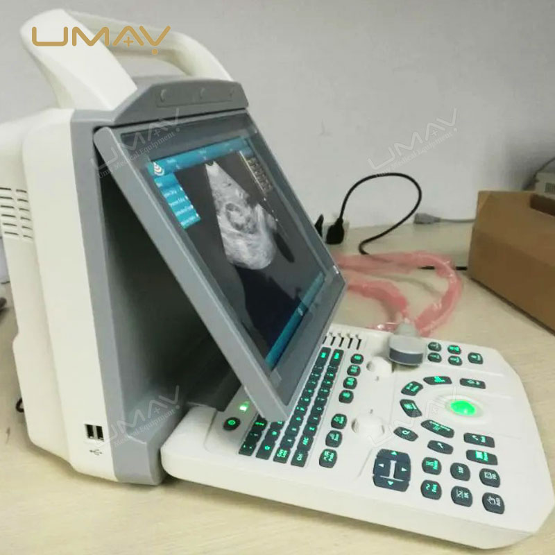 Portable Black and White Ultrasound Scanner with 12-Inch LED Screen for Human and Veterinary Use