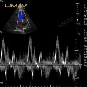 Portable Digital Color Doppler Ultrasound Machine for Human and Veterinary Use-1