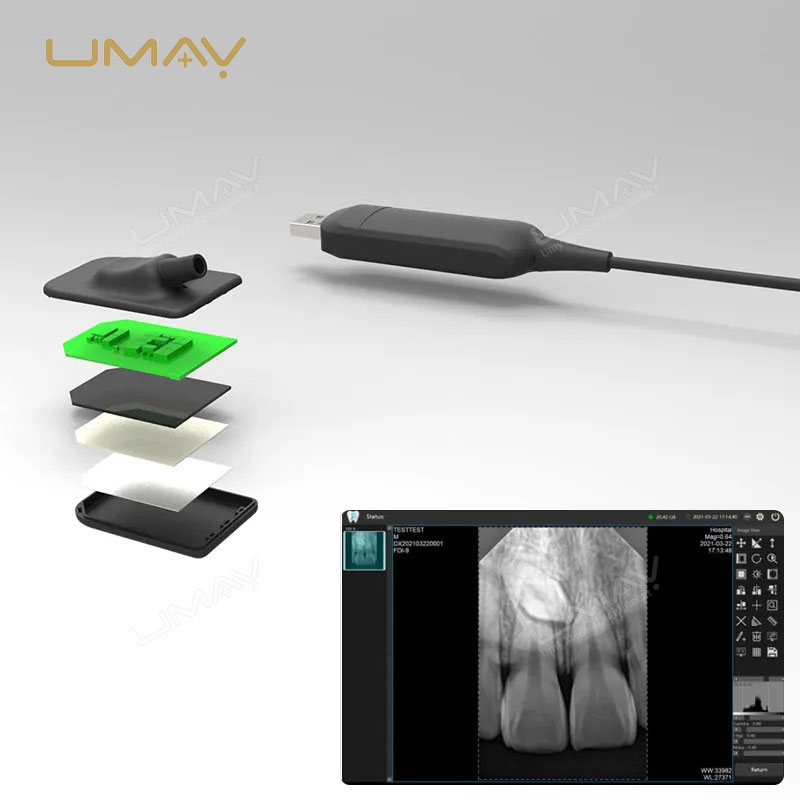 Portable Digital Dental X-ray Unit with Intraoral Radiography Sensor for Oral Treatment