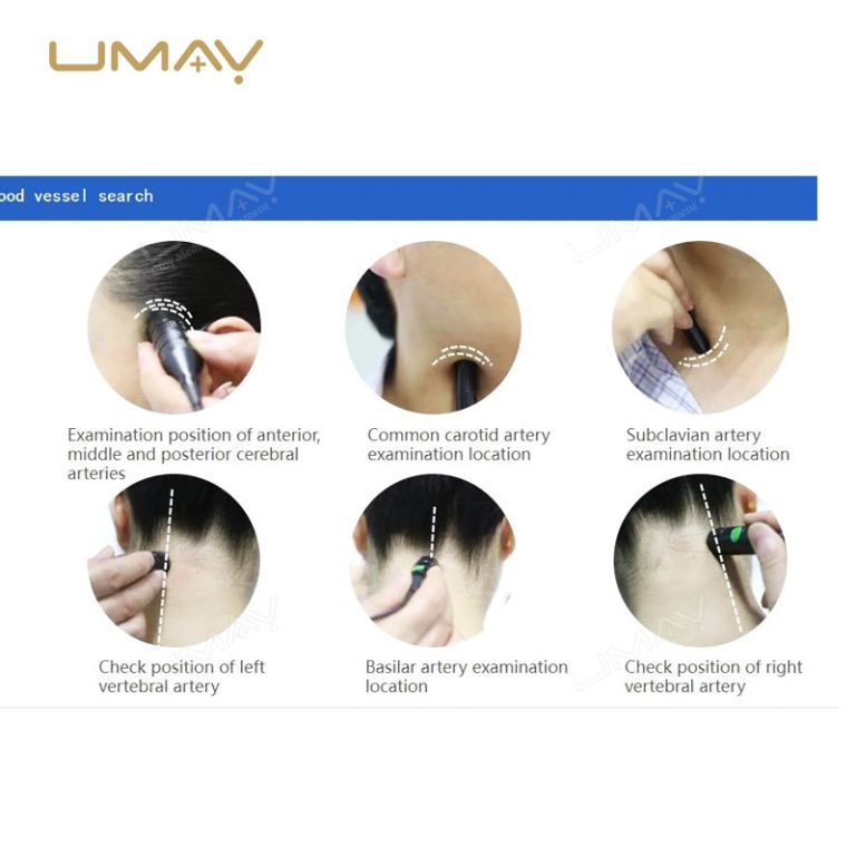 Single-Channel Transcranial Doppler Ultrasound System with 1-4 Probes for Blood Flow Velocity Measurement-2