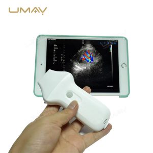 Wireless Phased Array Cardiac Ultrasound Probe for Echocardiography-1