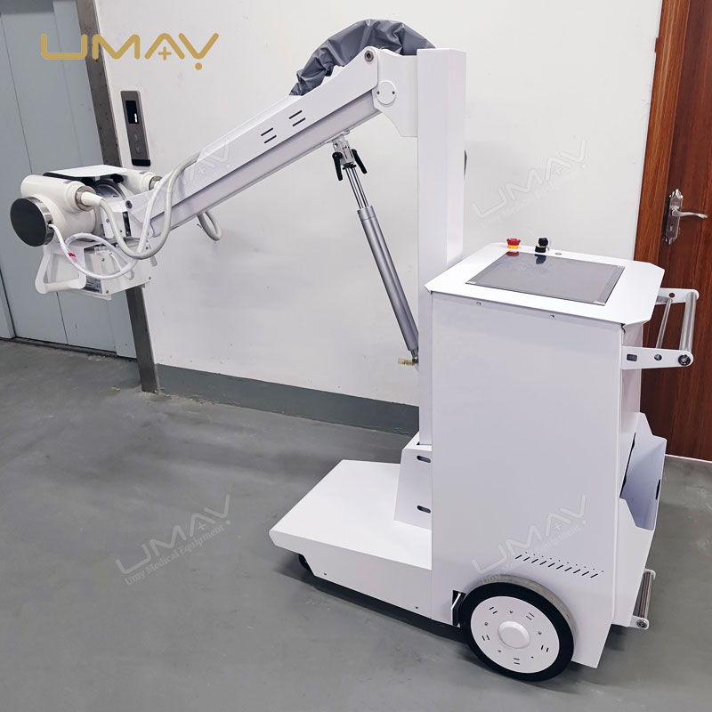 High Frequency Mobile X-ray Machine 20 Kw with Screening System UMY-XM-MO02