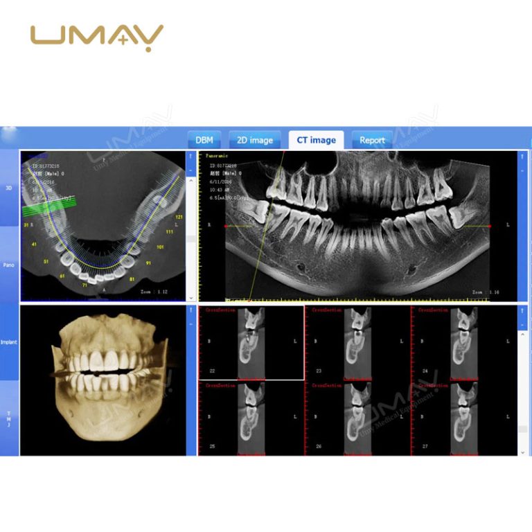 3D CBCT Dental Panoramic X-Ray Machine for Fine-Detail Imaging-1